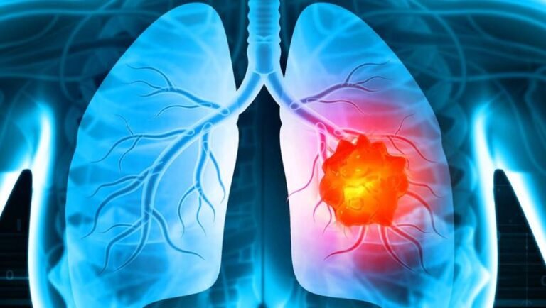 Over 32,000 Cancer Cases Reported in Jammu & Kashmir; 79% Burden Falls on Kashmir Valley, Says Health Minister